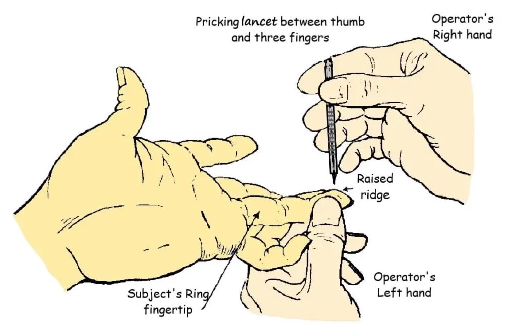 HOW TO PRICK THE FINGER?