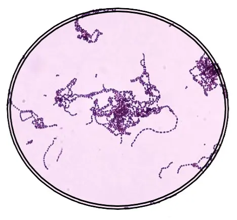 streptococcus pyogenes morphology
