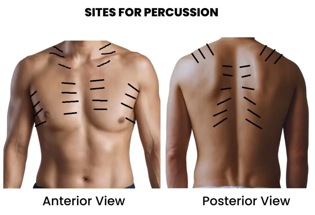 CLINICAL EXAMINATION OF RESPIRATORY SYSTEM-SITES FOR PERCUSSION