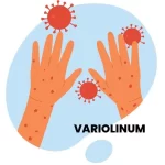 VARILINUM