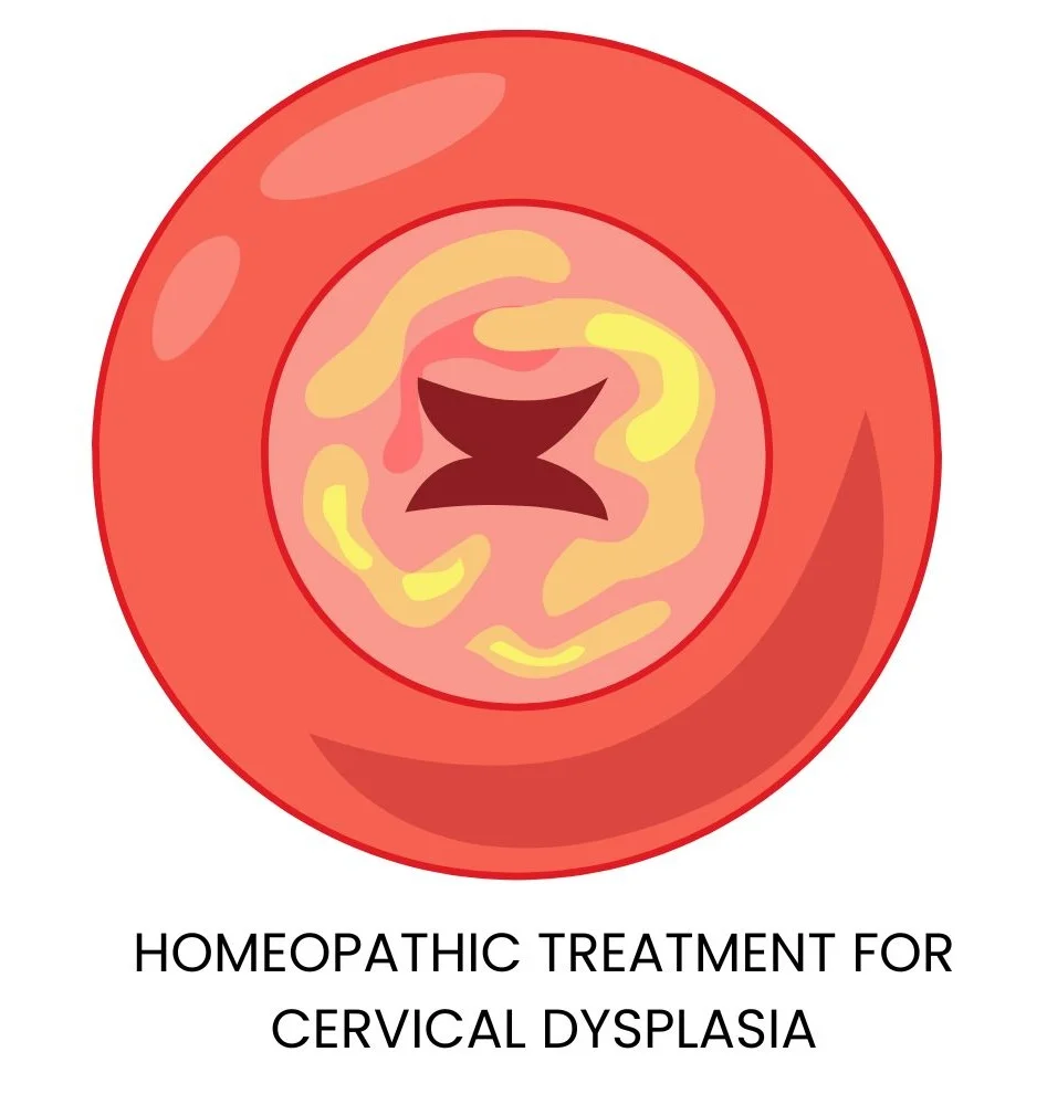 HOMEOPATHIC TREATMENT FOR CERVICAL DYSPLASIA: NATURAL HEALING WITHOUT SURGERY
