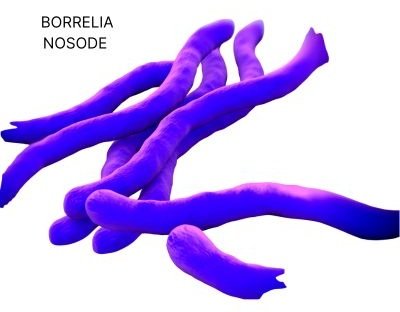 BORRELIA NOSODE IN HOMEOPATHY: COMPLETE REMEDY PROFILE, PATHOGENESIS, AND CLINICAL USE