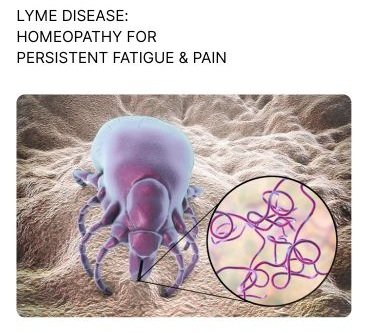 LYME DISEASE HOMEOPATHIC TREATMENT FOR PERSISTENT FATIGUE AND PAIN