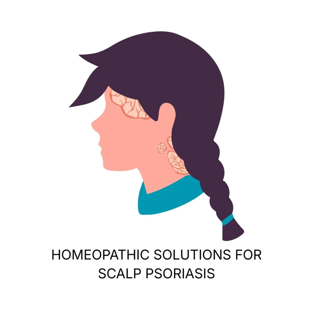 Home | Medicosage HOMEOPATHIC SOLUTIONS FOR SCALP PSORIASIS NATURAL REMEDIES CAUSES SYMPTOMS & HOLISTIC TREATMENT