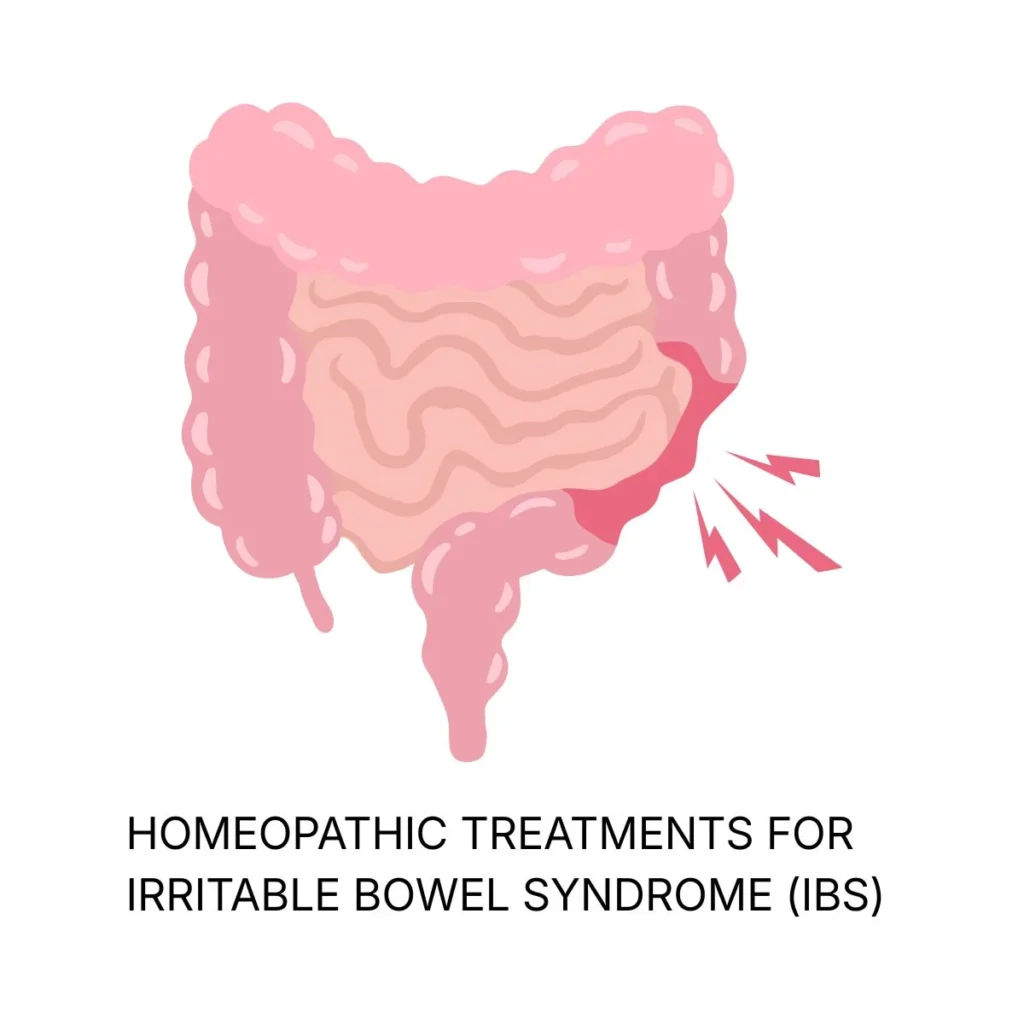 HOMEOPATHIC TREATMENTS FOR IRRITABLE BOWEL SYNDROME (IBS) NATURAL RELIEF FOR DIGESTIVE HEALTH